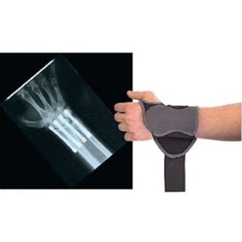 Mueller HG80 Wrist Support 